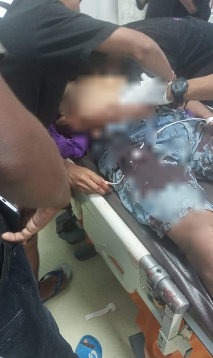 Pemotor Hilang Kendali, Tabrak Pejalan Kaki di Mimika Hingga Keduanya Dilarikan ke RS