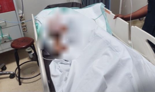 Dua Pria Bertetangga Duel, Satu Orang Dilarikan ke Rumah Sakit